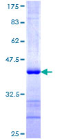 ATG3 Protein - 12.5% SDS-PAGE Stained with Coomassie Blue.