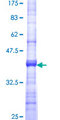 ATL1 Protein - 12.5% SDS-PAGE Stained with Coomassie Blue.