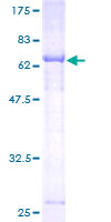 ATL2 Protein - 12.5% SDS-PAGE of human ARL6IP2 stained with Coomassie Blue