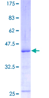 ATM Protein - 12.5% SDS-PAGE of human ATM stained with Coomassie Blue