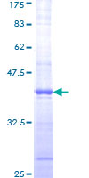 ATM Protein - 12.5% SDS-PAGE Stained with Coomassie Blue.