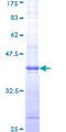 ATM Protein - 12.5% SDS-PAGE Stained with Coomassie Blue.