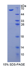 ATM Protein - Recombinant  Ataxia Telangiectasia Mutated By SDS-PAGE
