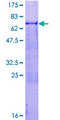 ATOH1 / MATH-1 Protein - 12.5% SDS-PAGE of human ATOH1 stained with Coomassie Blue