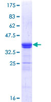 ATOH1 / MATH-1 Protein - 12.5% SDS-PAGE Stained with Coomassie Blue.