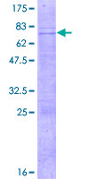 ATOH8 Protein - 12.5% SDS-PAGE of human ATOH8 stained with Coomassie Blue