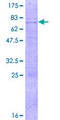ATOH8 Protein - 12.5% SDS-PAGE of human ATOH8 stained with Coomassie Blue