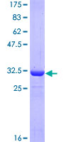 ATOX1 Protein - 12.5% SDS-PAGE Stained with Coomassie Blue.