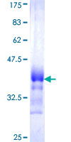ATP11B Protein - 12.5% SDS-PAGE Stained with Coomassie Blue.
