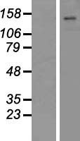 ATP11C Protein - Western validation with an anti-DDK antibody * L: Control HEK293 lysate R: Over-expression lysate