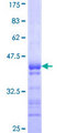 ATP12A Protein - 12.5% SDS-PAGE Stained with Coomassie Blue.