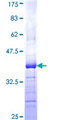 ATP13A2 Protein - 12.5% SDS-PAGE Stained with Coomassie Blue.