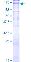 ATP1A3 Protein - 12.5% SDS-PAGE of human ATP1A3 stained with Coomassie Blue