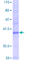 ATP1A3 Protein - 12.5% SDS-PAGE Stained with Coomassie Blue.