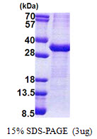 ATP1B1 Protein