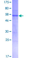 ATP1B3 Protein - 12.5% SDS-PAGE of human ATP1B3 stained with Coomassie Blue