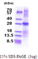 ATP1B3 Protein