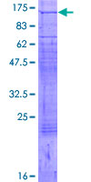 ATP2A1 / SERCA1 Protein - 12.5% SDS-PAGE of human ATP2A1 stained with Coomassie Blue