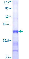 ATP2A1 / SERCA1 Protein - 12.5% SDS-PAGE Stained with Coomassie Blue.
