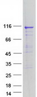 ATP2A1 / SERCA1 Protein - Purified recombinant protein ATP2A1 was analyzed by SDS-PAGE gel and Coomassie Blue Staining