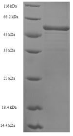 ATP2A2 / SERCA2 Protein - (Tris-Glycine gel) Discontinuous SDS-PAGE (reduced) with 5% enrichment gel and 15% separation gel.