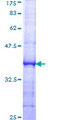 ATP2A3 / SERCA3 Protein - 12.5% SDS-PAGE Stained with Coomassie Blue.