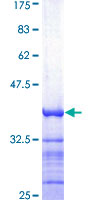 ATP2B1 / PMCA1 Protein - 12.5% SDS-PAGE Stained with Coomassie Blue.