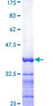 ATP2B1 / PMCA1 Protein - 12.5% SDS-PAGE Stained with Coomassie Blue.