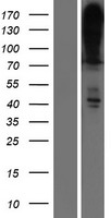 ATP2B4 / PMCA4 Protein - Western validation with an anti-DDK antibody * L: Control HEK293 lysate R: Over-expression lysate