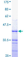 ATP2B4 / PMCA4 Protein - 12.5% SDS-PAGE Stained with Coomassie Blue.