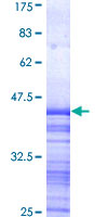 ATP2C1 Protein - 12.5% SDS-PAGE Stained with Coomassie Blue.