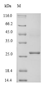 ATP4B Protein - (Tris-Glycine gel) Discontinuous SDS-PAGE (reduced) with 5% enrichment gel and 15% separation gel.