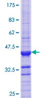 ATP4B Protein - 12.5% SDS-PAGE Stained with Coomassie Blue.