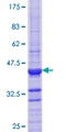 ATP4B Protein - 12.5% SDS-PAGE Stained with Coomassie Blue.