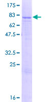 ATP5A1 / ATP Synthase Alpha Protein - 12.5% SDS-PAGE of human ATP5A1 stained with Coomassie Blue