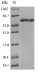 ATP5B / ATP Synthase Beta Protein - (Tris-Glycine gel) Discontinuous SDS-PAGE (reduced) with 5% enrichment gel and 15% separation gel.