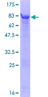 ATP5B / ATP Synthase Beta Protein - 12.5% SDS-PAGE of human ATP5B stained with Coomassie Blue