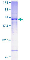 ATP5C1 Protein - 12.5% SDS-PAGE of human ATP5C1 stained with Coomassie Blue