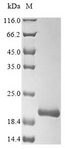 ATP5D Protein - (Tris-Glycine gel) Discontinuous SDS-PAGE (reduced) with 5% enrichment gel and 15% separation gel.