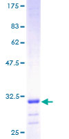 ATP5E Protein - 12.5% SDS-PAGE of human ATP5E stained with Coomassie Blue
