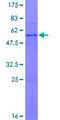 ATP5F1 Protein - 12.5% SDS-PAGE of human ATP5F1 stained with Coomassie Blue