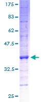 ATP5G1 / ATP5G Protein - 12.5% SDS-PAGE of human ATP5G1 stained with Coomassie Blue