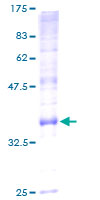 ATP5G2 Protein - 12.5% SDS-PAGE of human ATP5G2 stained with Coomassie Blue