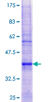 ATP5G3 Protein - 12.5% SDS-PAGE of human ATP5G3 stained with Coomassie Blue