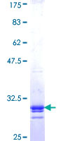ATP5G3 Protein - 12.5% SDS-PAGE Stained with Coomassie Blue.