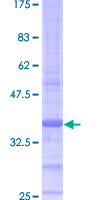 ATP5J Protein - 12.5% SDS-PAGE of human ATP5J stained with Coomassie Blue