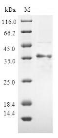 ATP5J Protein - (Tris-Glycine gel) Discontinuous SDS-PAGE (reduced) with 5% enrichment gel and 15% separation gel.