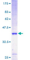 ATP5J2 / F1Fo-ATPase Protein - 12.5% SDS-PAGE of human ATP5J2 stained with Coomassie Blue