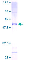 ATP5O Protein - 12.5% SDS-PAGE of human ATP5O stained with Coomassie Blue