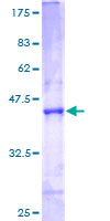 ATP5S Protein - 12.5% SDS-PAGE of human ATP5S stained with Coomassie Blue